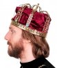 Korona bez wkładu - King Deluxe I